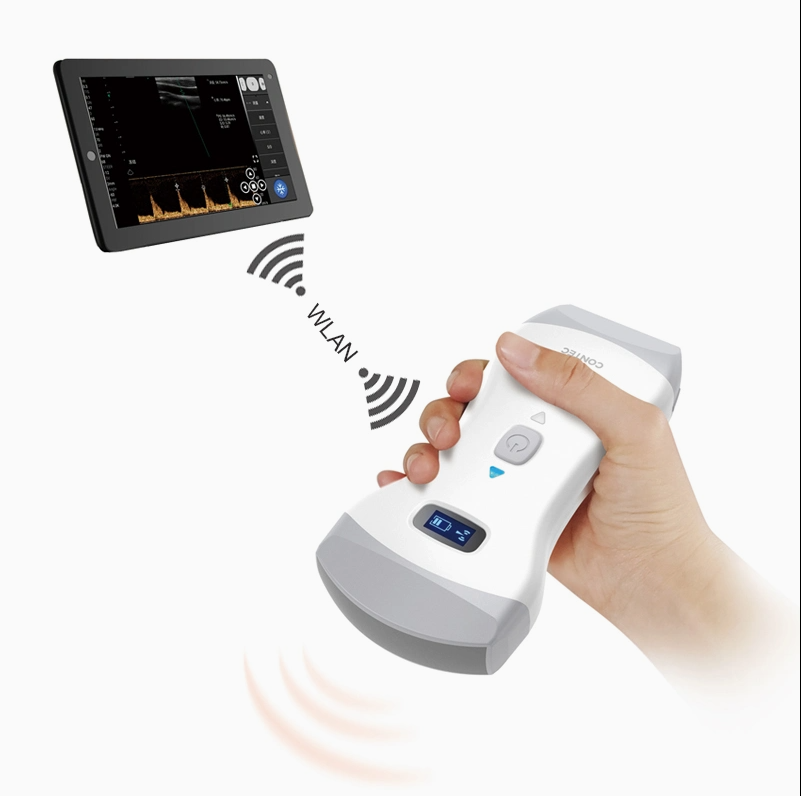 Handheld Ultrasound Dual Probe Colour Doppler Diagnostic System