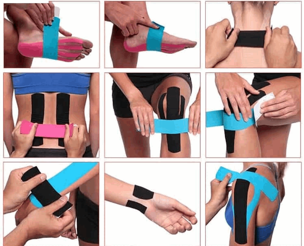 Kinesiology Tape