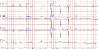 ECG Paper from R 83 Shop now at Josec Supplies