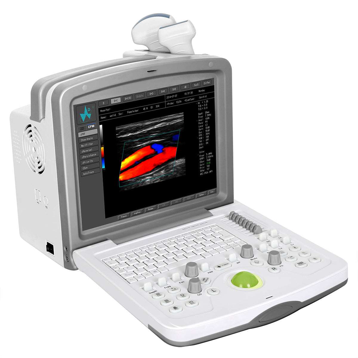 Welld FDC6000 Full Color Ultrasound from R 209632 Shop now at Josec Supplies