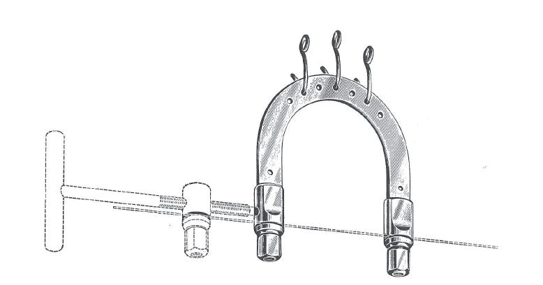 Kirschner Wire Traction Bow - Josec Supplies